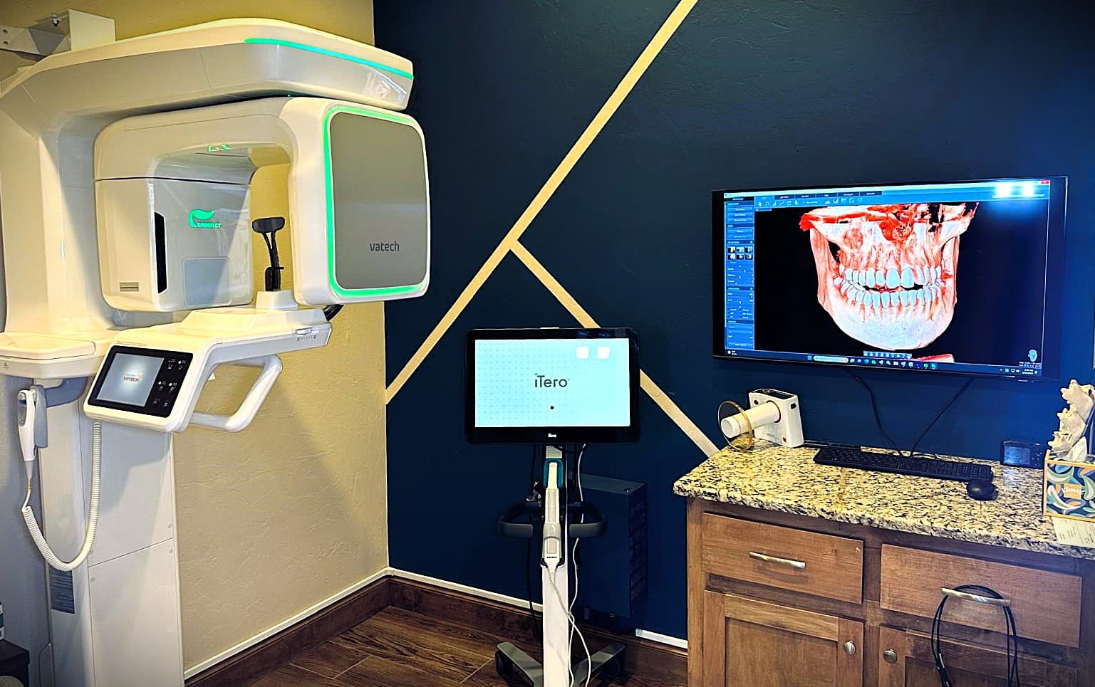 Imaging room at Dental Art Center: a Vatech CBCT unit, an iTero intraoral scanner, and a 3D CBCT reconstruction of a jaw on the wall screen